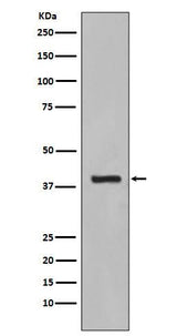 Anti-Cytokeratin 19 KRT19 Rabbit Monoclonal Antibody Boster Bio