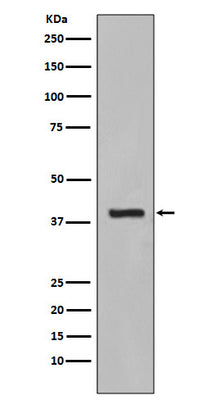 Anti-Cytokeratin 19 KRT19 Rabbit Monoclonal Antibody Boster Bio