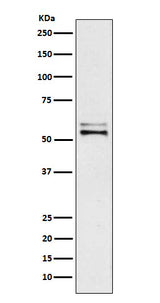 Anti-Angiotensinogen Rabbit Monoclonal Antibody Boster Bio
