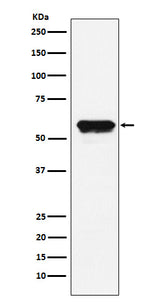 Anti-Angiotensinogen Rabbit Monoclonal Antibody Boster Bio