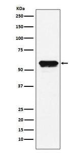 Anti-Angiotensinogen Rabbit Monoclonal Antibody Boster Bio