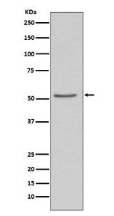 Anti-Angiotensinogen AGT Rabbit Monoclonal Antibody Boster Bio