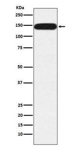 Anti-Pumilio 1 Rabbit Monoclonal Antibody Boster Bio