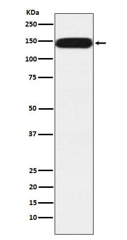 Anti-Pumilio 1 Rabbit Monoclonal Antibody Boster Bio