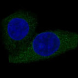 Anti-CPT2 Rabbit Monoclonal Antibody Boster Bio