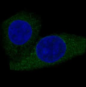 Anti-CPT2 Rabbit Monoclonal Antibody Boster Bio
