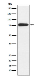 Anti-MARK2 Rabbit Monoclonal Antibody Boster Bio