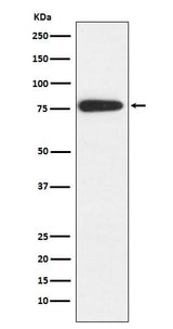 Anti-MARK2 Rabbit Monoclonal Antibody Boster Bio