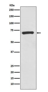 Anti-CD73 Rabbit Monoclonal Antibody Boster Bio