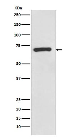 Anti-CD73 Rabbit Monoclonal Antibody Boster Bio