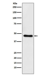 Anti-CtBP1 Rabbit Monoclonal Antibody Boster Bio