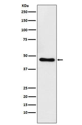 Anti-CtBP1 Rabbit Monoclonal Antibody Boster Bio