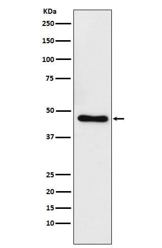 Anti-CtBP1 Rabbit Monoclonal Antibody Boster Bio