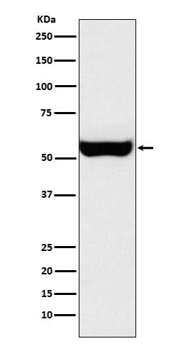 Anti-Monoamine Oxidase B Rabbit Monoclonal Antibody Boster Bio