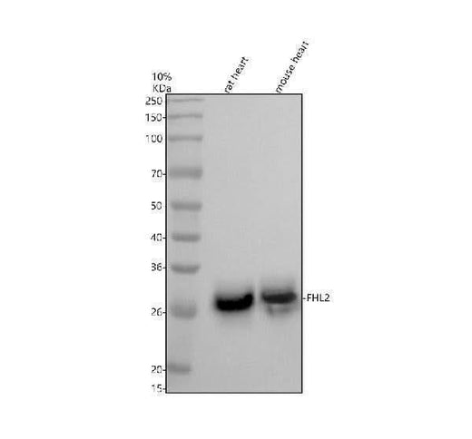 Anti-FHL2 Rabbit Monoclonal Antibody Boster Bio