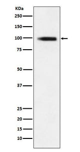 Anti-GIT1 Rabbit Monoclonal Antibody Boster Bio