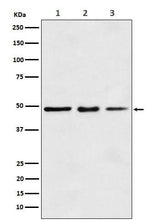 Anti-eEF1A1 Rabbit Monoclonal Antibody Boster Bio