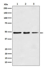 Anti-eEF1A1 Rabbit Monoclonal Antibody Boster Bio