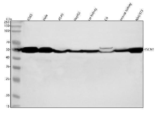 Anti-Fascin Monoclonal Antibody Boster Bio
