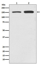 Anti-SMC1 SMC1A Rabbit Monoclonal Antibody Boster Bio