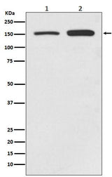 Anti-SMC1 SMC1A Rabbit Monoclonal Antibody Boster Bio