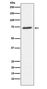 Anti-SENP1 Rabbit Monoclonal Antibody Boster Bio