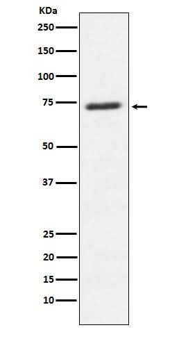 Anti-SENP1 Rabbit Monoclonal Antibody Boster Bio
