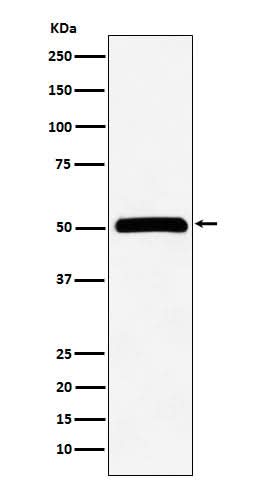 Anti-CELF1 Rabbit Monoclonal Antibody Boster Bio