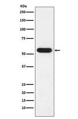 Anti-FKBP52 Rabbit Monoclonal Antibody Boster Bio