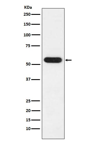 Anti-FKBP52 Rabbit Monoclonal Antibody Boster Bio