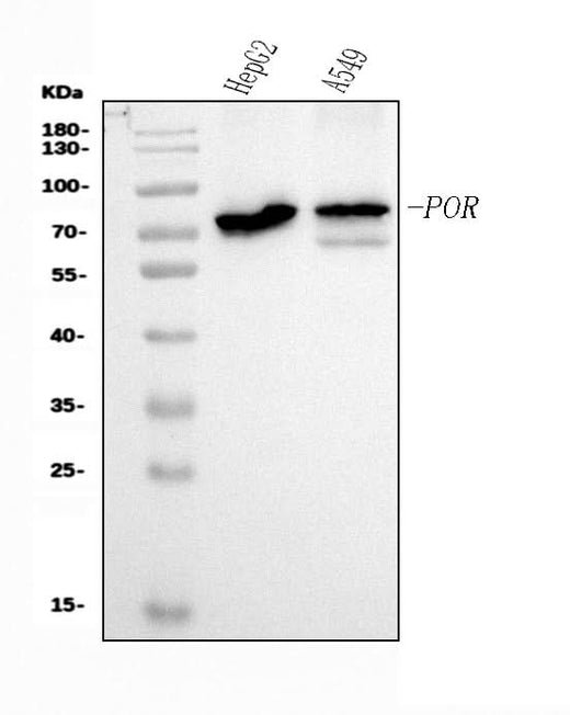 Anti-POR Antibody Picoband® (monoclonal, 7F5 Boster Bio