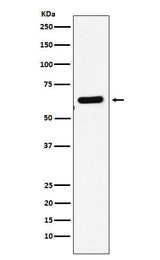 Anti-EHD1 Rabbit Monoclonal Antibody Boster Bio