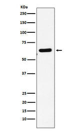 Anti-EHD1 Rabbit Monoclonal Antibody Boster Bio