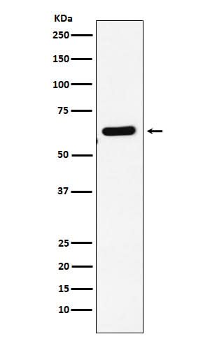 Anti-EHD1 Rabbit Monoclonal Antibody Boster Bio