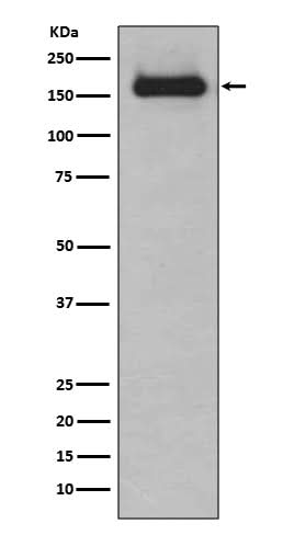 Anti-HDAC9 Rabbit Monoclonal Antibody Boster Bio