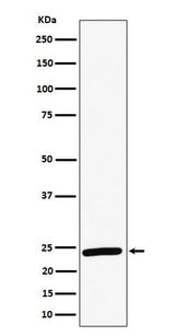 Anti-RAB8A Rabbit Monoclonal Antibody Boster Bio