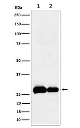 Anti-PHD3 Rabbit Monoclonal Antibody Boster Bio