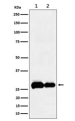Anti-PHD3 Rabbit Monoclonal Antibody Boster Bio
