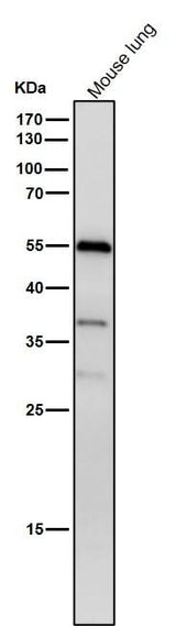 Anti-Phospho-beta Arrestin 1 (S412) Rabbit Monoclonal Antibody Boster Bio