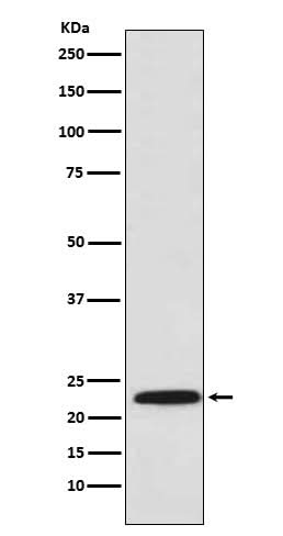 Anti-PSMB8 / LMP7 Monoclonal Antibody Boster Bio