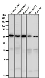 Anti-Caspase-10 Rabbit Monoclonal Antibody Boster Bio