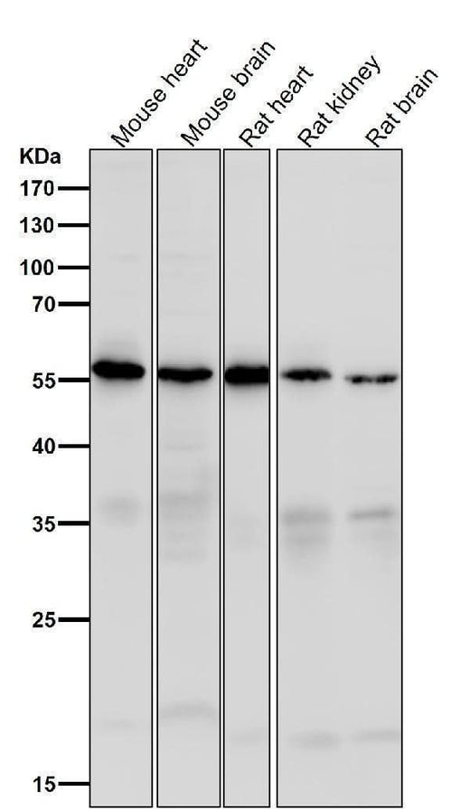 Anti-Caspase-10 Rabbit Monoclonal Antibody Boster Bio