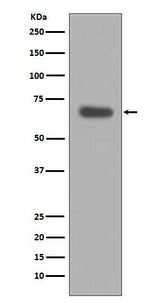 Anti-pro Caspase 10 Rabbit Monoclonal Antibody Boster Bio