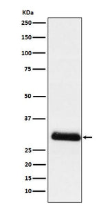Anti-ApoD Rabbit Monoclonal Antibody Boster Bio