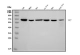 Anti-Transketolase/TKT Picoband® Antibody (monoclonal, 2I3 Boster Bio