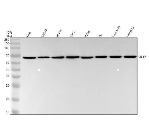 Anti-G3BP Rabbit Monoclonal Antibody Boster Bio