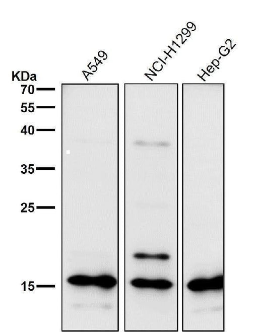 Anti-Uteroglobin SCGB1A1 Monoclonal Antibody Boster Bio