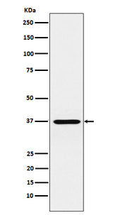Anti-CRX Monoclonal Antibody Boster Bio