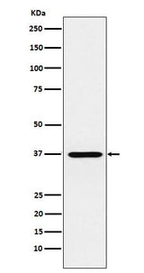 Anti-CRX Monoclonal Antibody Boster Bio