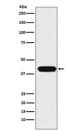Anti-ATOH1 Rabbit Monoclonal Antibody Boster Bio